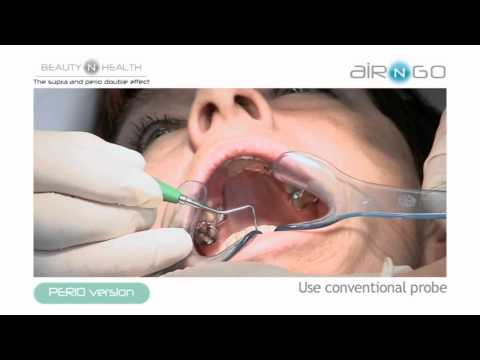 AIRNGO PERIO