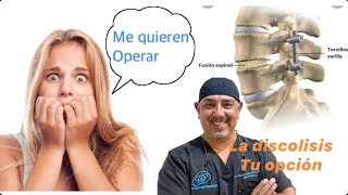 Hernia discal extruida en L3-L4