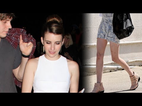 エマ・ロバーツが彼氏に噛みついた？ (Emma Roberts Bites Boyfriend?)