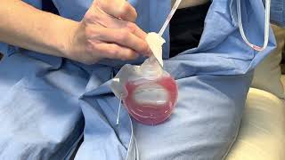Steven Teitelbaum MD