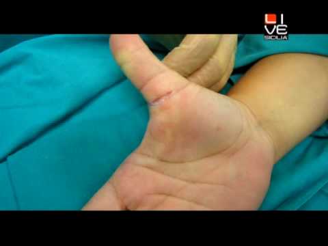 Dopo il parto male le ossa e ritorno Fase 2 osteocondrosi lombare