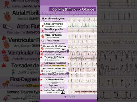 Sinus rhythm sinus tachycardia atrial fibrillation ventricular fibrillation heart block