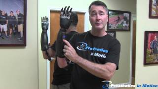 BeBionic 3 Myoelectric Prosthesis