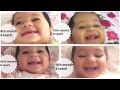 9 , 10 , 11 months old baby teething update | Progression videos incl break through