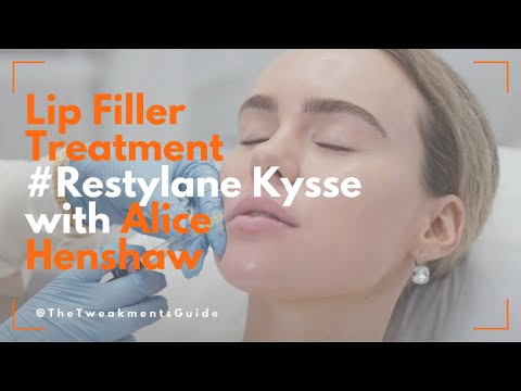 Lip Filler Treatment | # Kysse with Alice Henshaw