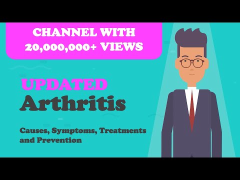 Arthritis - Causes, Symptoms, Treatments and Prevention