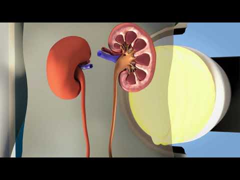 Lithotripsy Trailer Biomedical Engineers TV