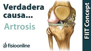 La verdadera causa de la artrosis (más allá de lo que te han contado)