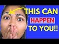 Get Rid Of Eyebrow Dandruff
