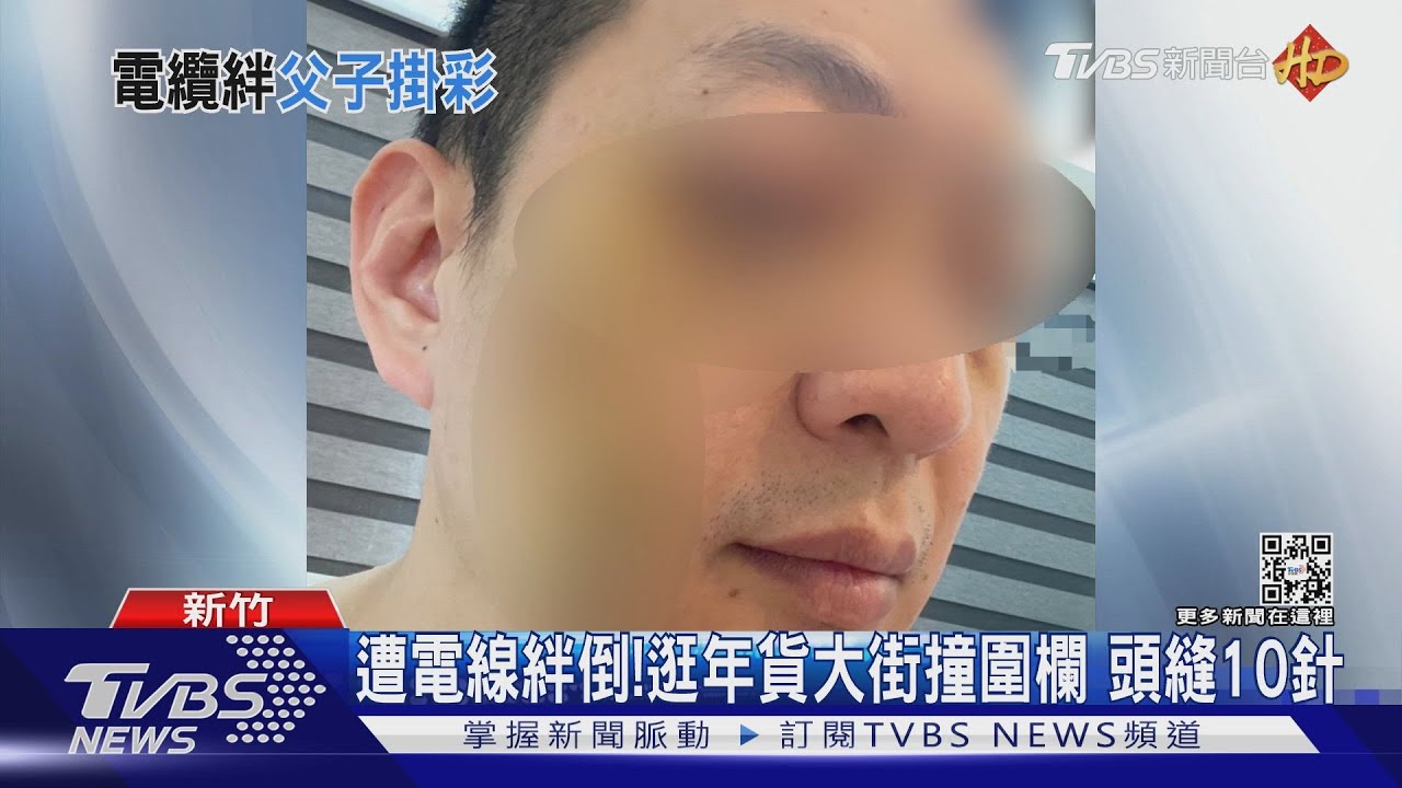 遭電線絆倒!逛年貨大街撞圍欄 頭縫10針