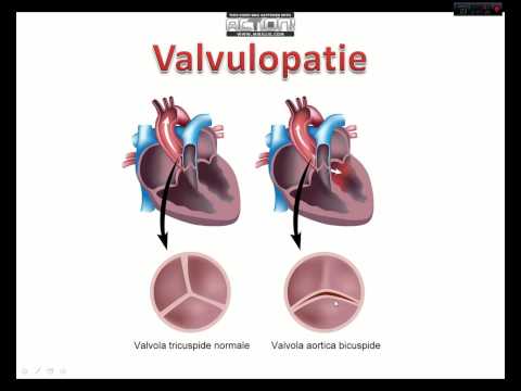 Dove fa male lanca Mentre lalimentazione il mal di schiena che fare