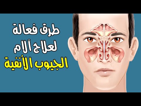 طرق فعالة لعلاج آلام الجيوب الأنفية