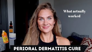Perioral Dermatitis Treatment