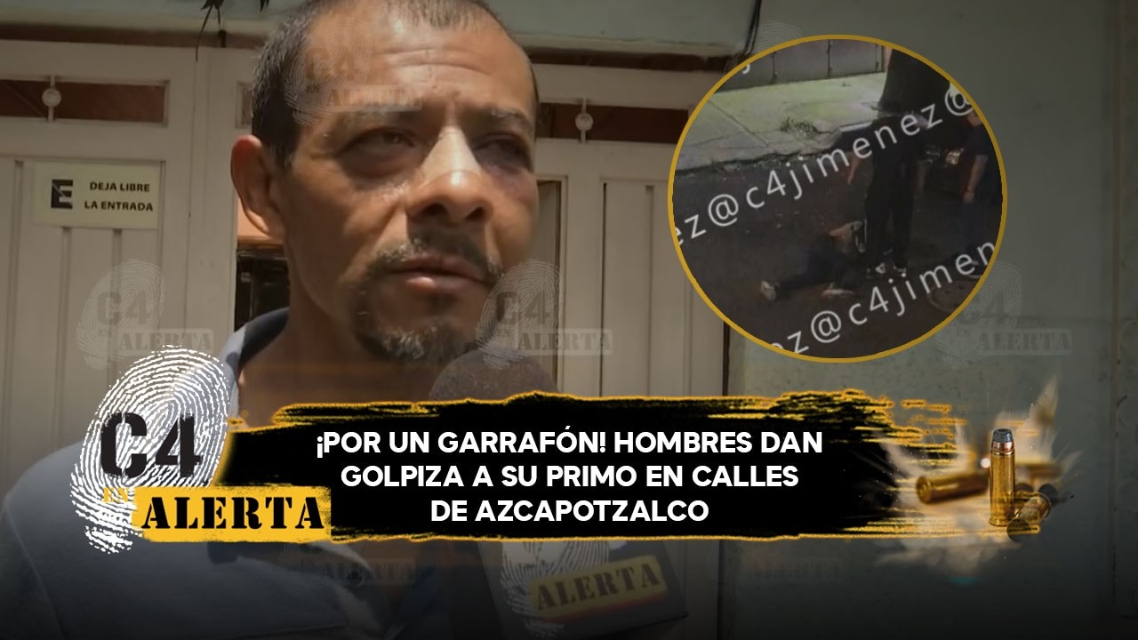 ¡Por un garrafón! Óscar es golpeado por sus primos en Azcapotzalco; le rompieron la nariz