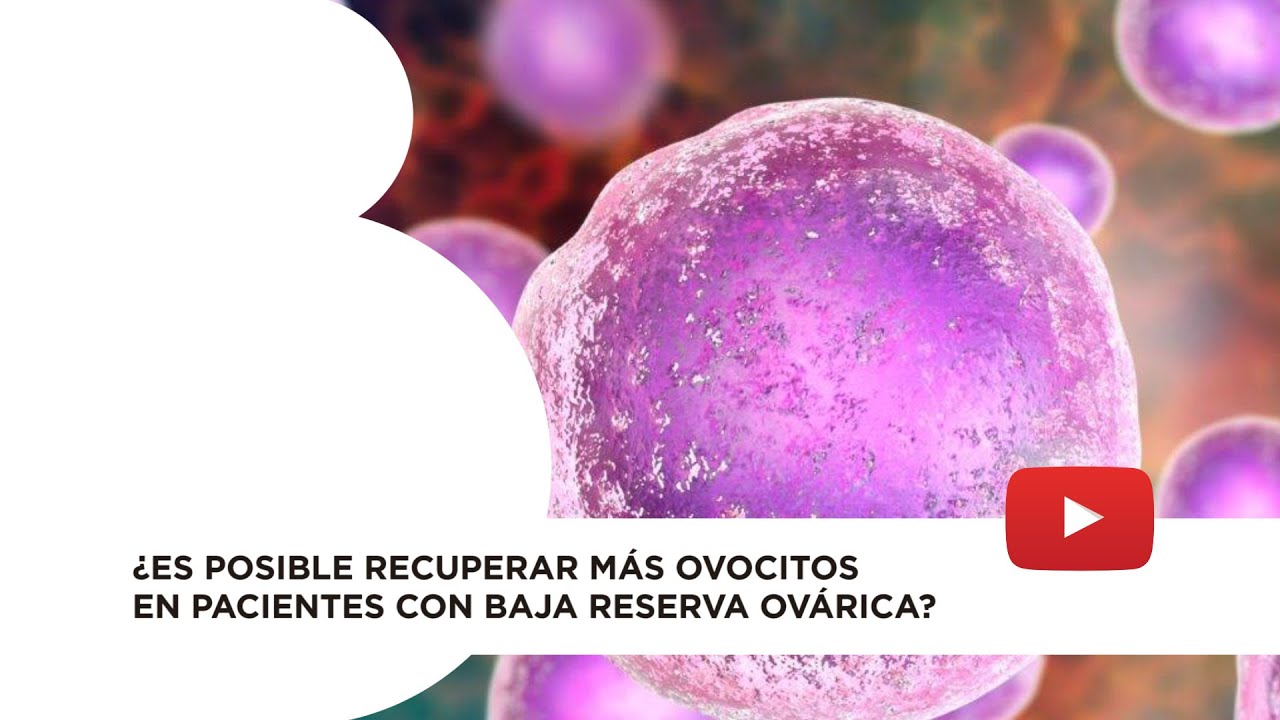 Watch Doble estimulación ovocitaria para pacientes con baja reserva ovárica Now Doble estimulación ovocitaria para pacientes con baja reserva ovárica