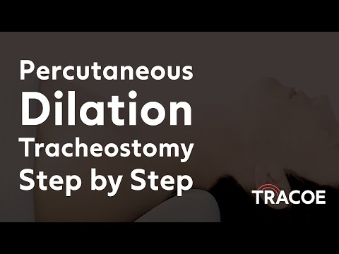 Percutaneous Dilation Tracheostomy Procedure Explained Step by Step