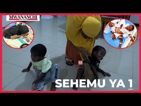 Simulizi ya mama alivyoshuhudia wanae pacha wakitengenishwa