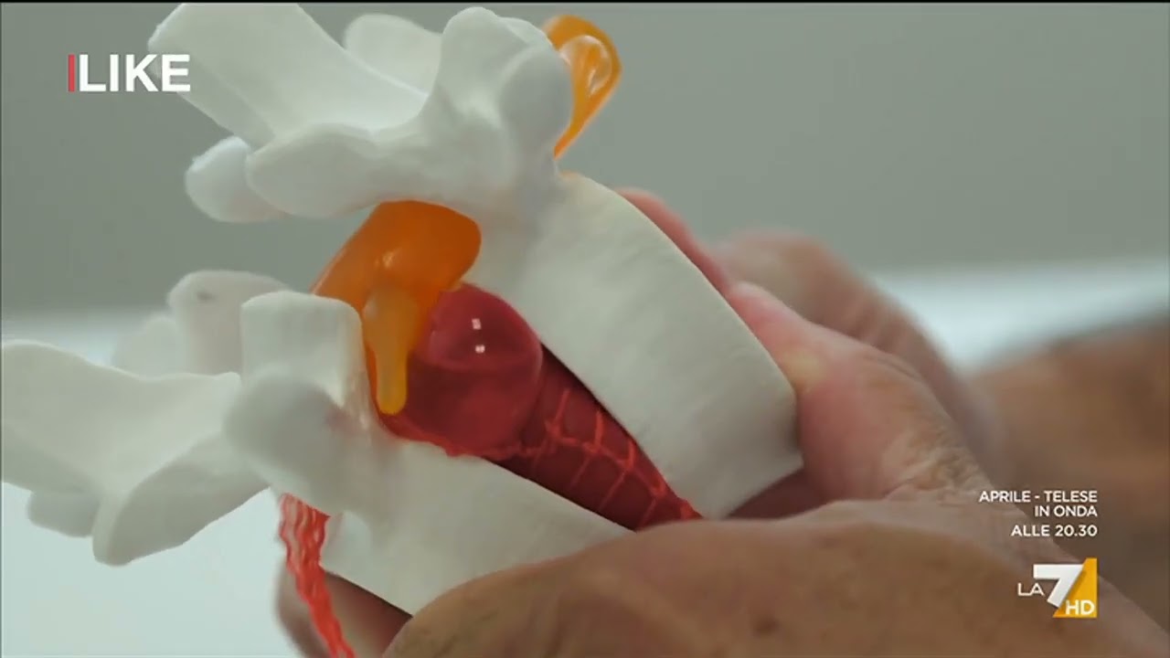 Ossigeno Ozonoterapia