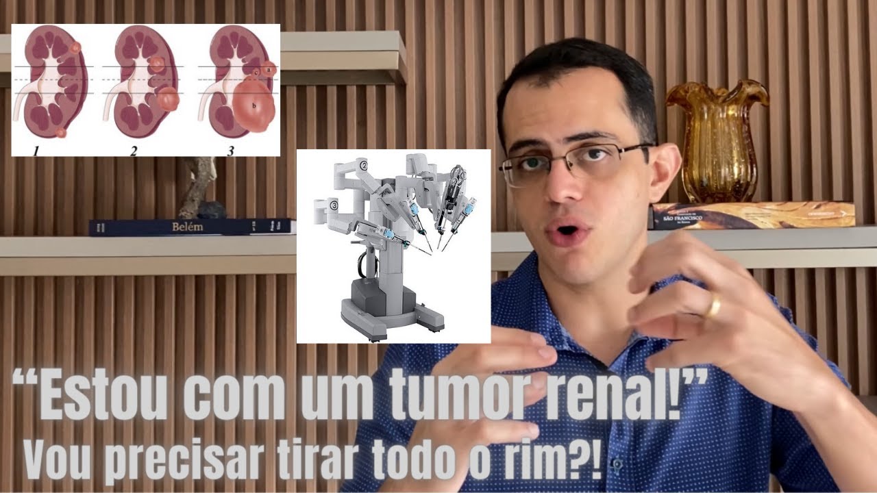 Tumor renal (Câncer de rim)! Como se apresenta, como é feito o diagnóstico e o tratamento!