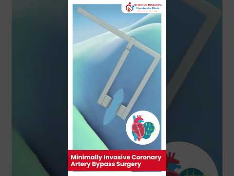Patient video testimonial 3