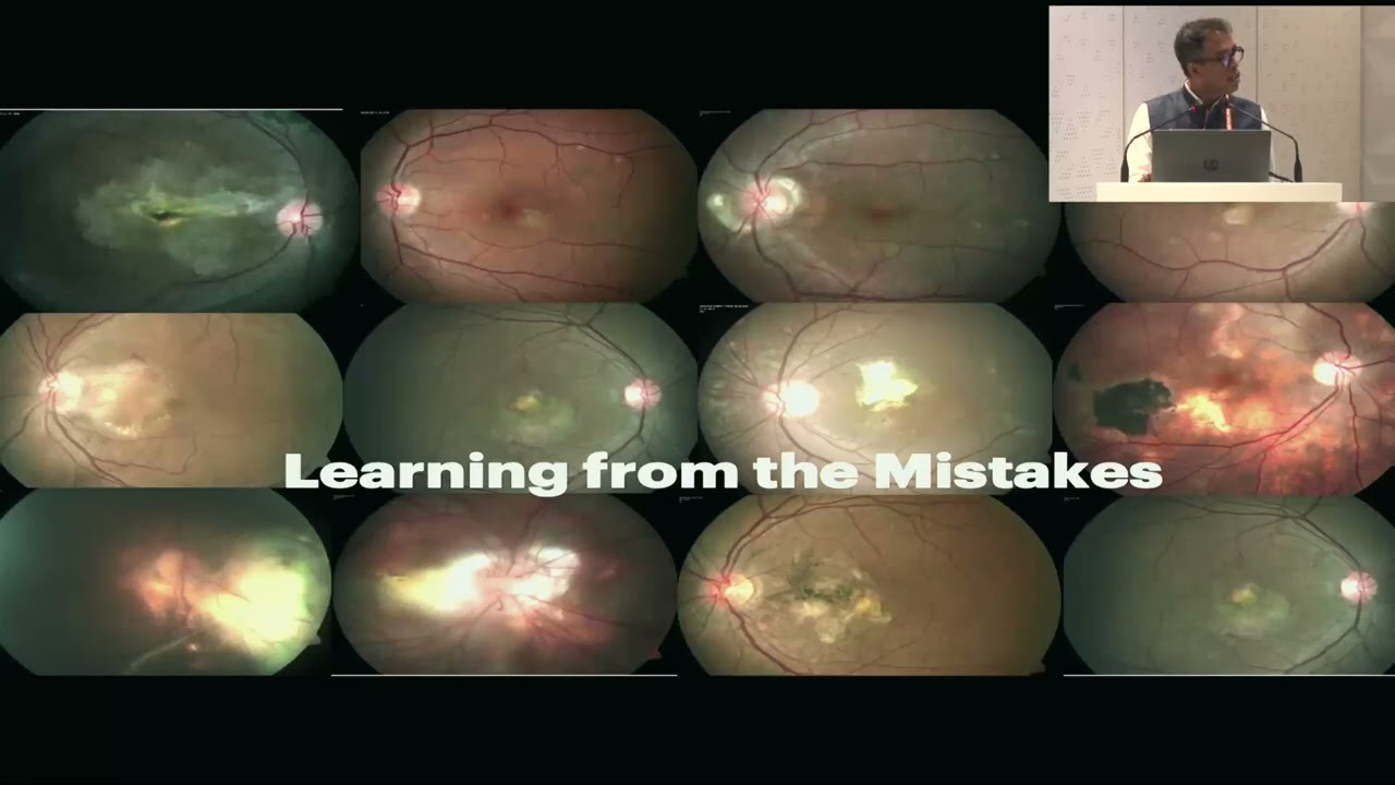 Warning Signs of Inflammatory Cnvm