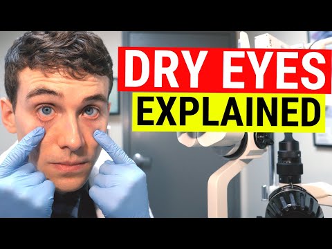 What Causes Dry Eyes? Eye Doctor Explains Dry Eye Syndrome Video