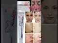 Skin Shine Cream Haircare Skinbeautytips Skincareproduct Beauty Ytshorts Skincareroutine