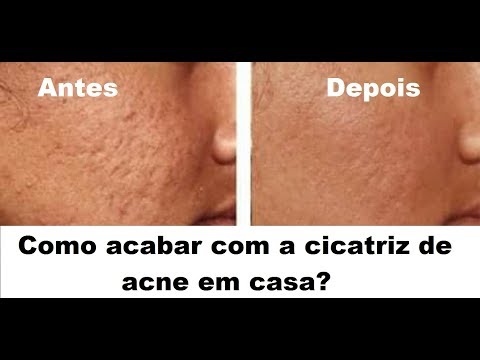 Gli oli da pigmentary notano su mani Lentiggini fatti curiosi