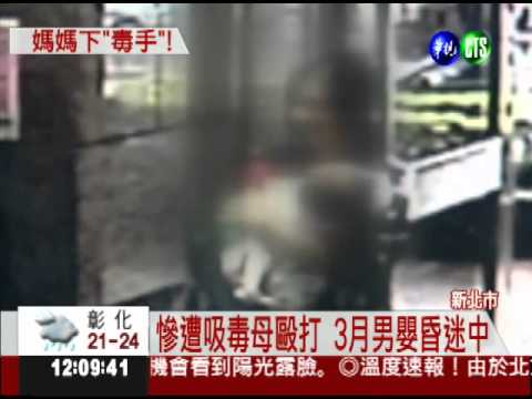 媽媽下"毒手"! 小男嬰一身瘀青