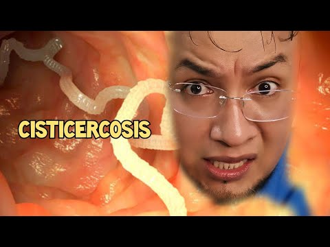 , title : '¿Qué causa la cisticercosis?'