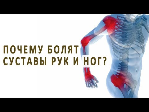 Почему болят суставы рук и ног?