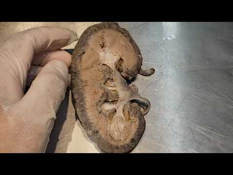 Anatomia do sistema urinário