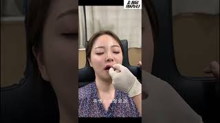 대부분 모르는 입술 필러의 심각한 부작용