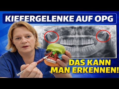 Kiefergelenke im OPG richtig beurteilen – DAS kann man wirklich erkennen!