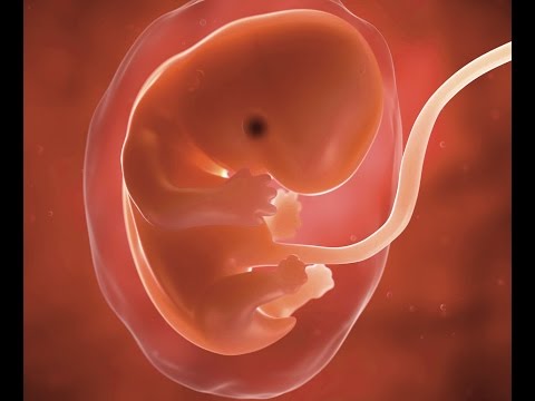 Dystonie idiopathique Qui a augmenté chez les patients hypertendus