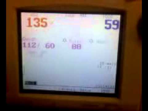 Kaylee Elizabeth heartbeat