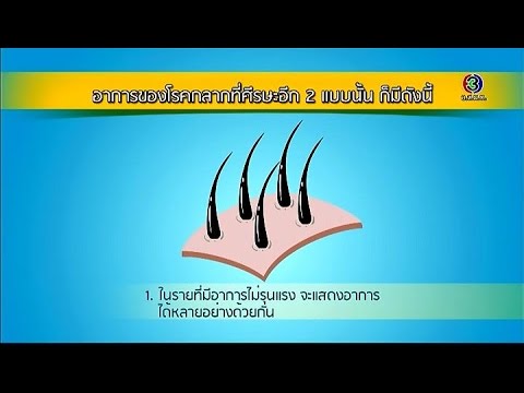 โรคสะเก็ดเงิน pustular และโรคเริม กลากประสาทบนเท้าของเขา