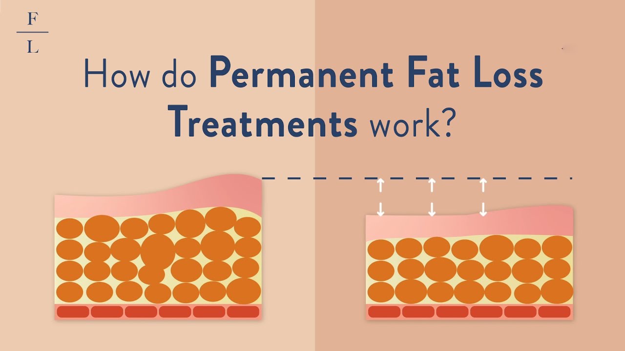 How do Permanent Fat Loss Treatments work? | DrFL explains