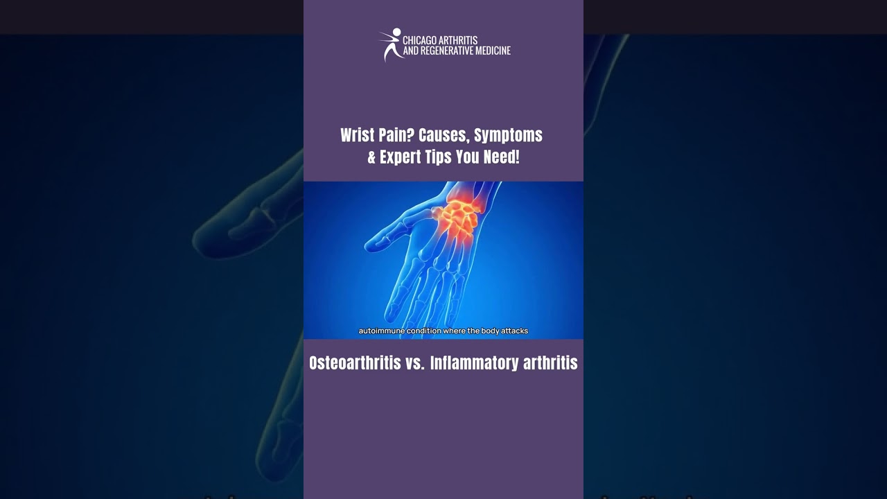 Osteoarthritis vs. Inflammatory Arthritis | Discover Wrist Pain Causes, Symptoms & Expert Tips
