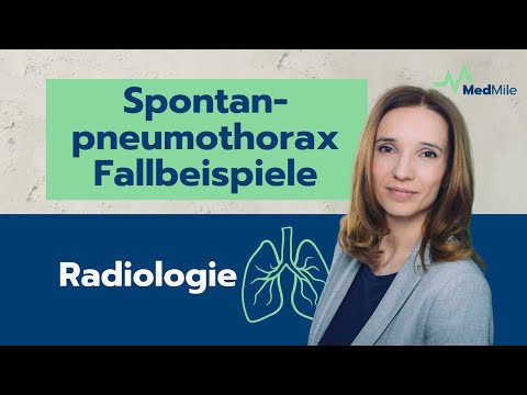 Spontaneous pneumothorax – case studies explained by Denisa Schnierer