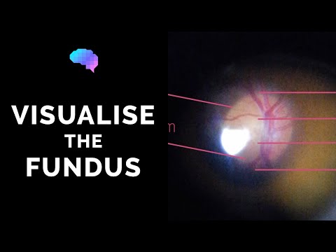 Fundoscopy | How to Visualise the Fundus | Direct Ophthalmoscopy | OSCE Guide | UKMLA | CPSA