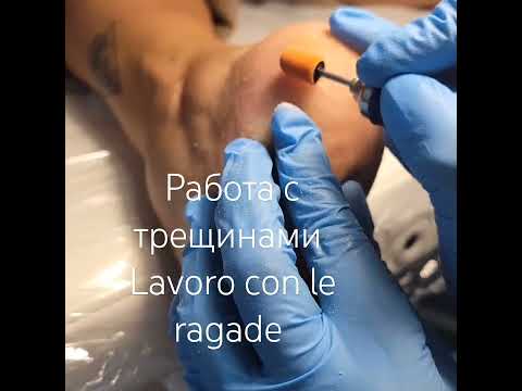 Lavoro con le ragade.Работа с трещинами.