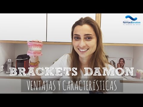download lagu mp3 mp4 Brackets Autoligables Damon, download lagu Brackets Autoligables Damon gratis, unduh video klip Brackets Autoligables Damon