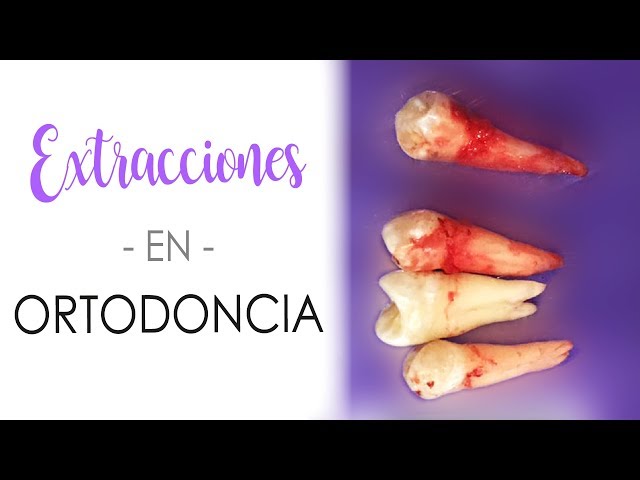 Center for Advanced Studies in Orthodontics A.C. video #1
