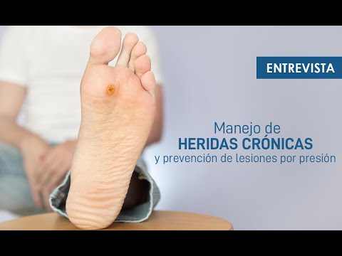 Heridas crónicas