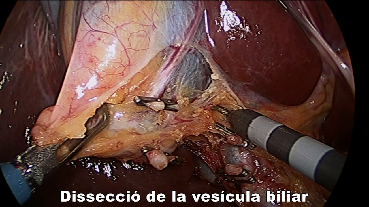 Xavier Botet Del Castillo-10