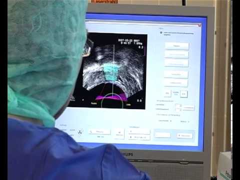 Aktive Punkte für die Behandlung von Prostatitis Prostatitis als zu Hause behandelt