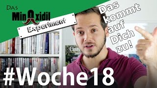 Das Minoxidil Experiment #Woche18 Das kommt auf Dich zu!