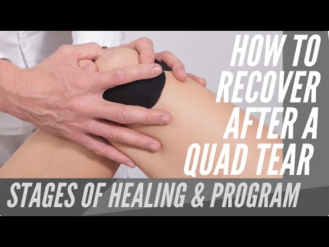 How to properly STAGE AND TREAT a quadrIceps (quad) tear | 4 Exercise REHAB PROGRAM