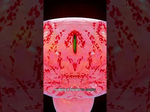 What Happens When You Hold Pee for Too Long 😱 #short #urineinfection - Creativelearning3d